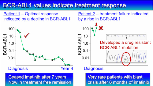 BCR-ABL1 levels indicate molecular response 