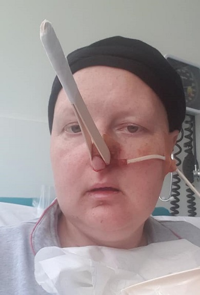 Rowena suffered a six-hour nosebleed during her first round of chemotherapy.