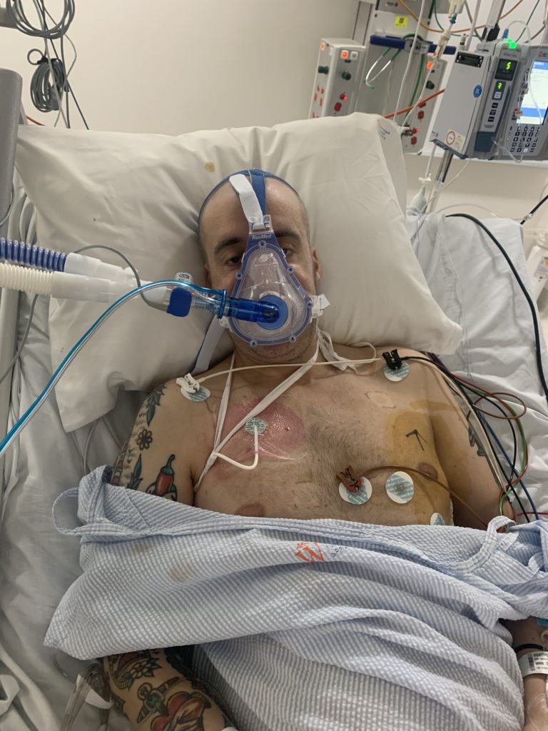 Transplant complications sent Nick to intensive care on a ventilator