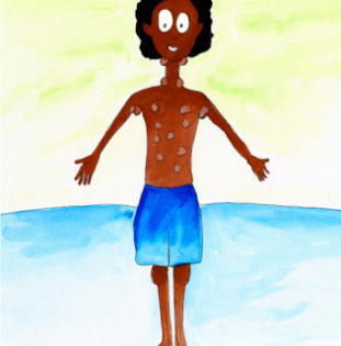 Illustration of a young man with various lumps on his body