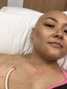 Yani Zhao in treatment.