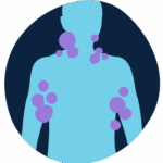 Lumps symptom