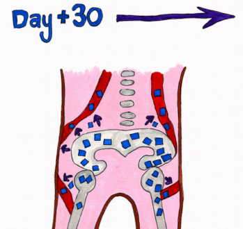 Illustration of the inside of a body, showing where young blood cells are moving out of hip bones and into the blood in veins, with the words 'Day +30' above it.